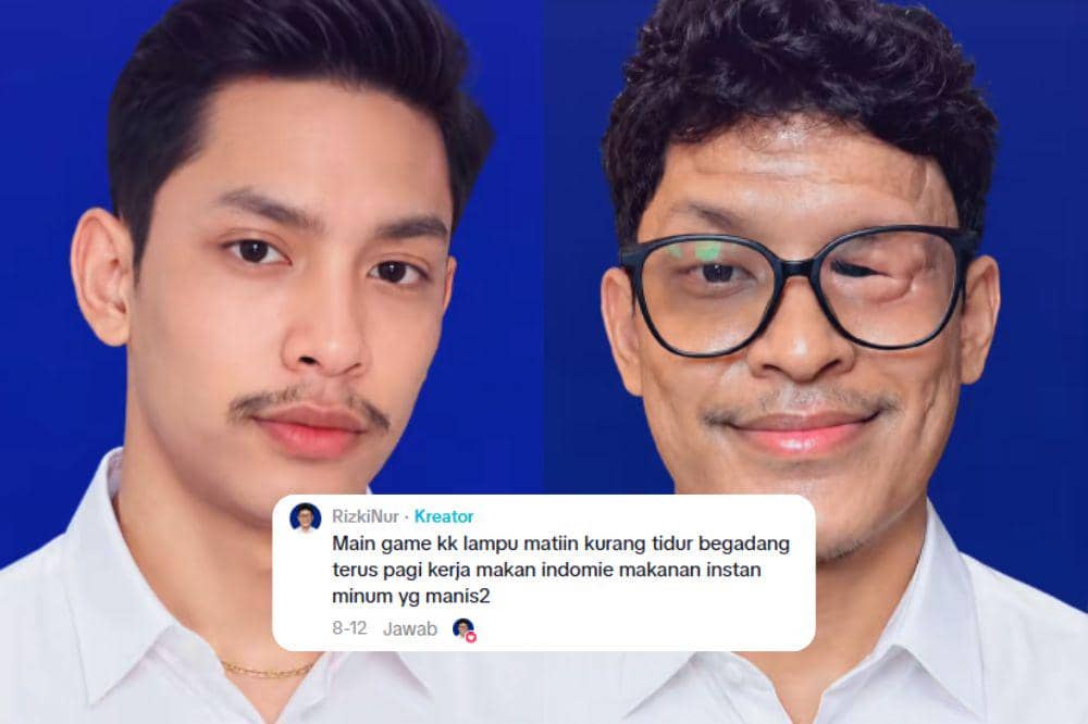 Laki-Laki Medan Ini Mengaku Bola Mata Diangkat karena Sering Main Game