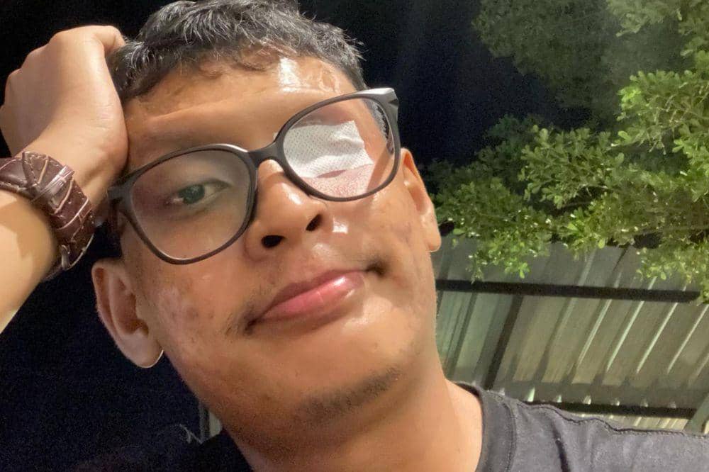 Kondisinya kemudian memburuk dan menimbulkan keluhan lain