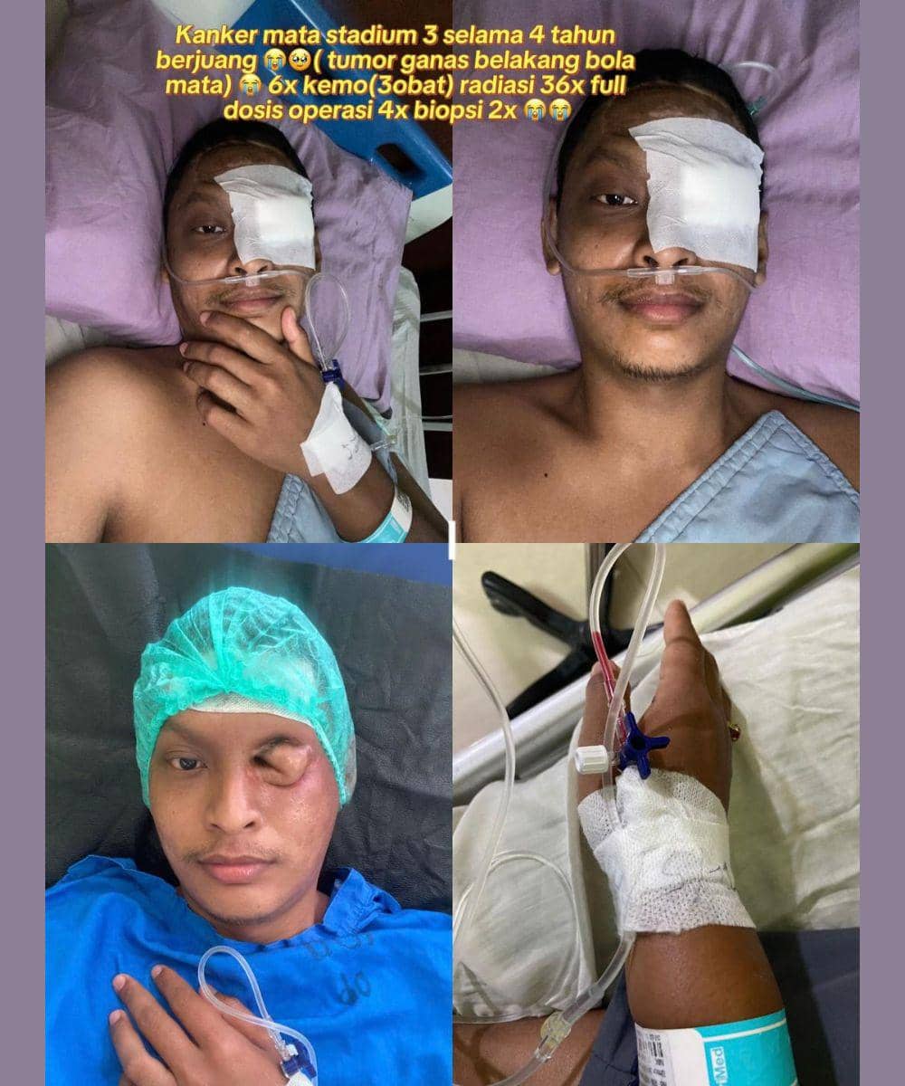 Diagnosis awal sempat mengarah ke retinoblastoma