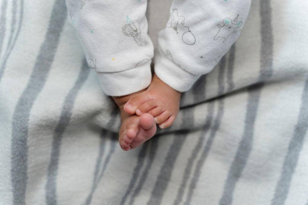 Kaki Bayi Sering Menyilang, Benarkah Tanda Cerebral Palsy?
