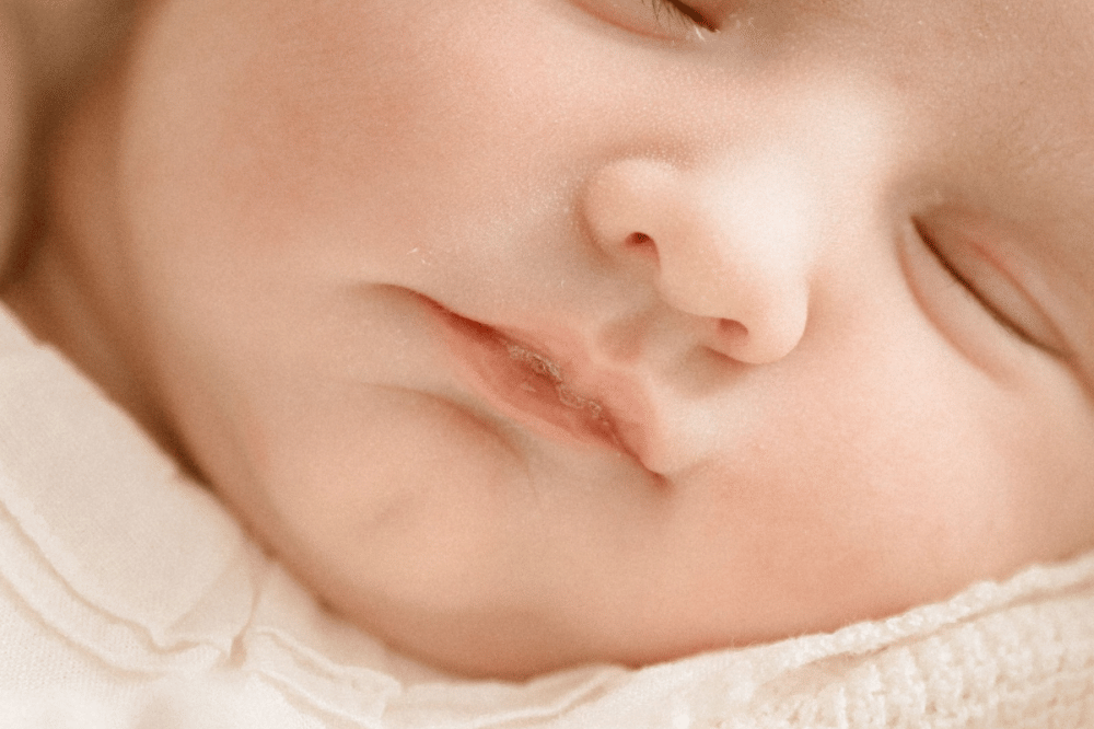 Penyebab bibir bayi pecah-pecah