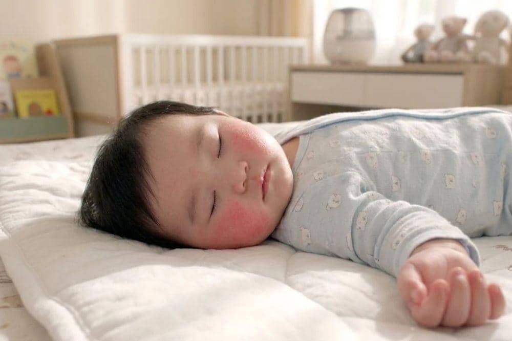 Apa itu ruam alergi susu sapi pada bayi
