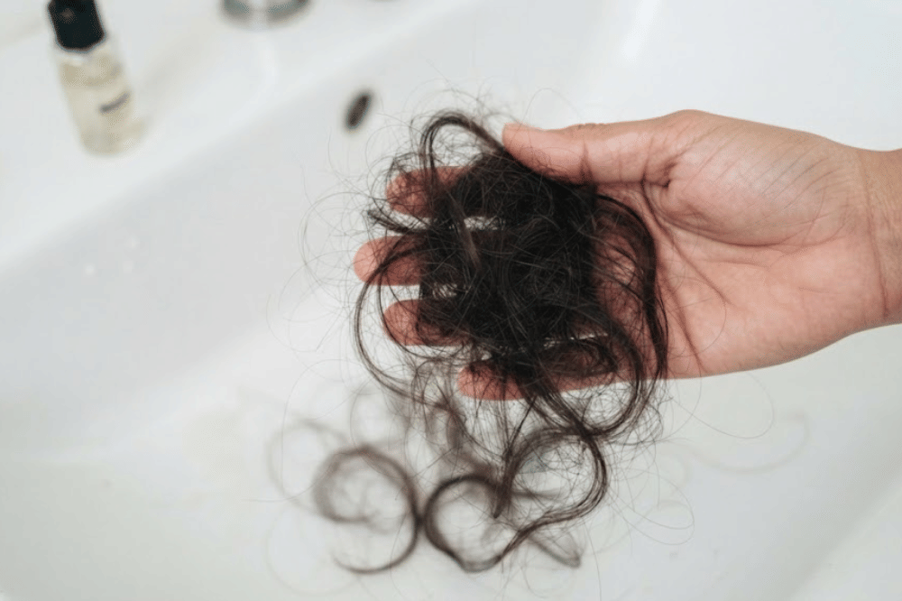 Tekanan konstan memicu traction alopecia