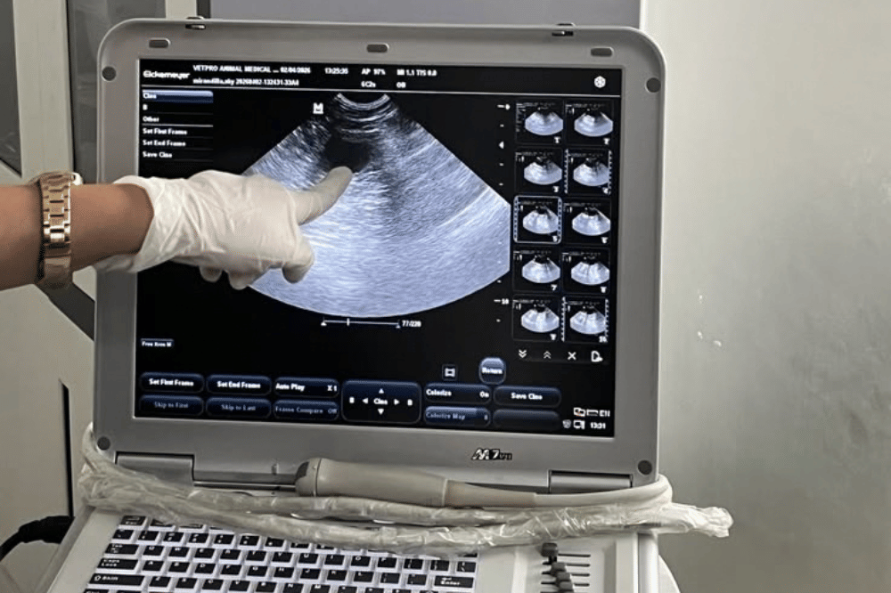 Cara Membaca Hasil Tes USG Transvaginal