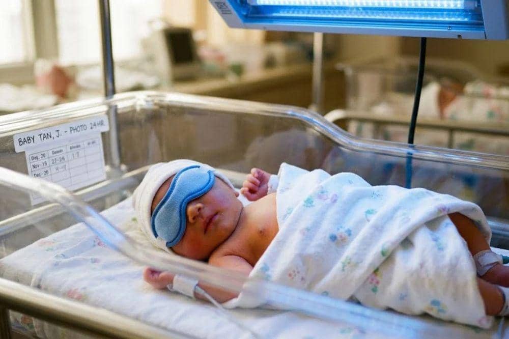 Berapa lama bayi kuning mengalami kantuk berlebihan