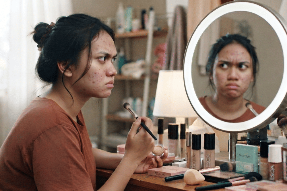 Cara Menutupi Bekas Jerawat dengan Makeup, Ini Beberapa Tekniknya