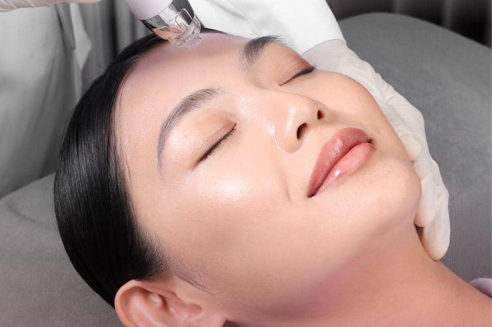 DNA Salmon dan LHALA Peel, Kombinasi Treatment Kulit Glowing