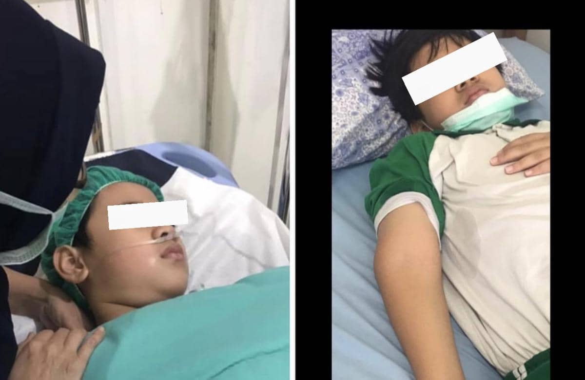 Korban bully di SD Sukabumi