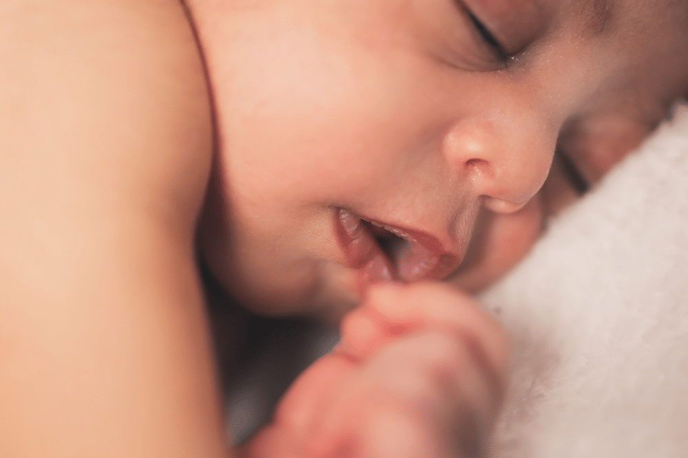 5 Penyebab Bibir Bayi Putih, Kenali Blister atau Bibir Melepuh
