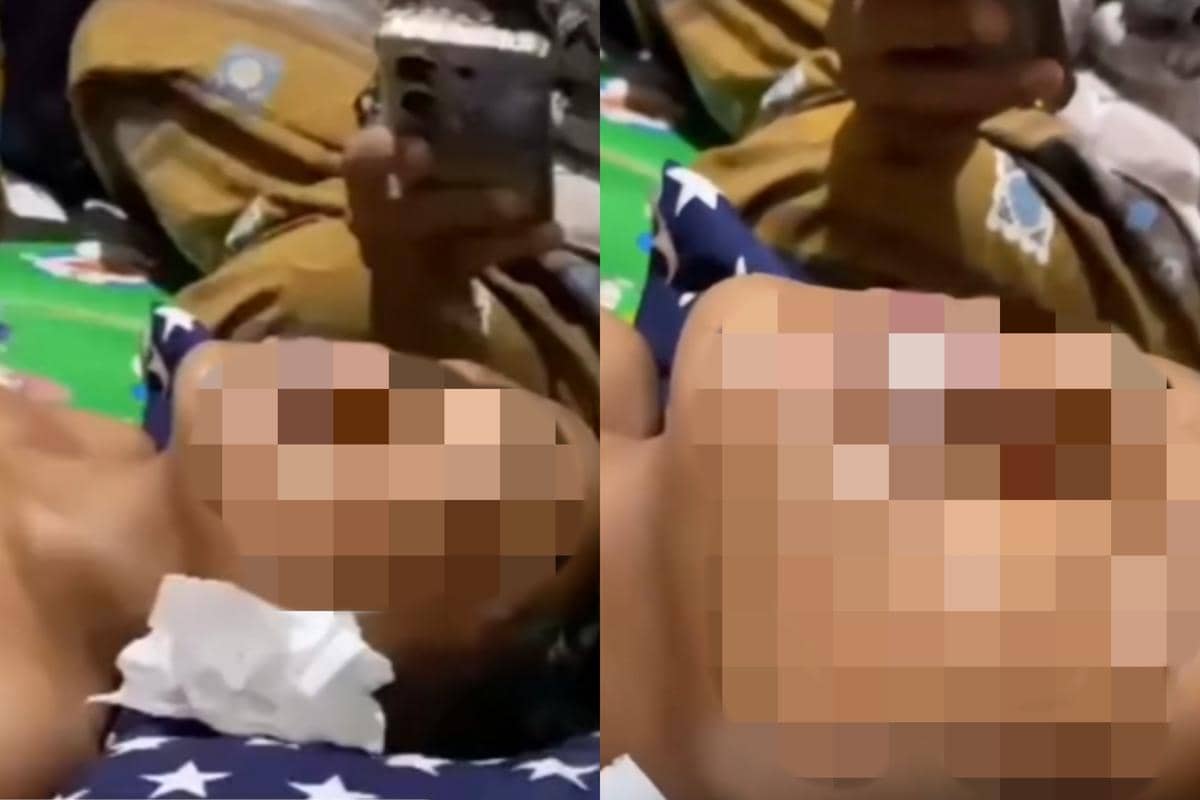 Miris! Santri di Pamekasan Diduga Dipukul 7 Senior Pakai Kawat Panas
