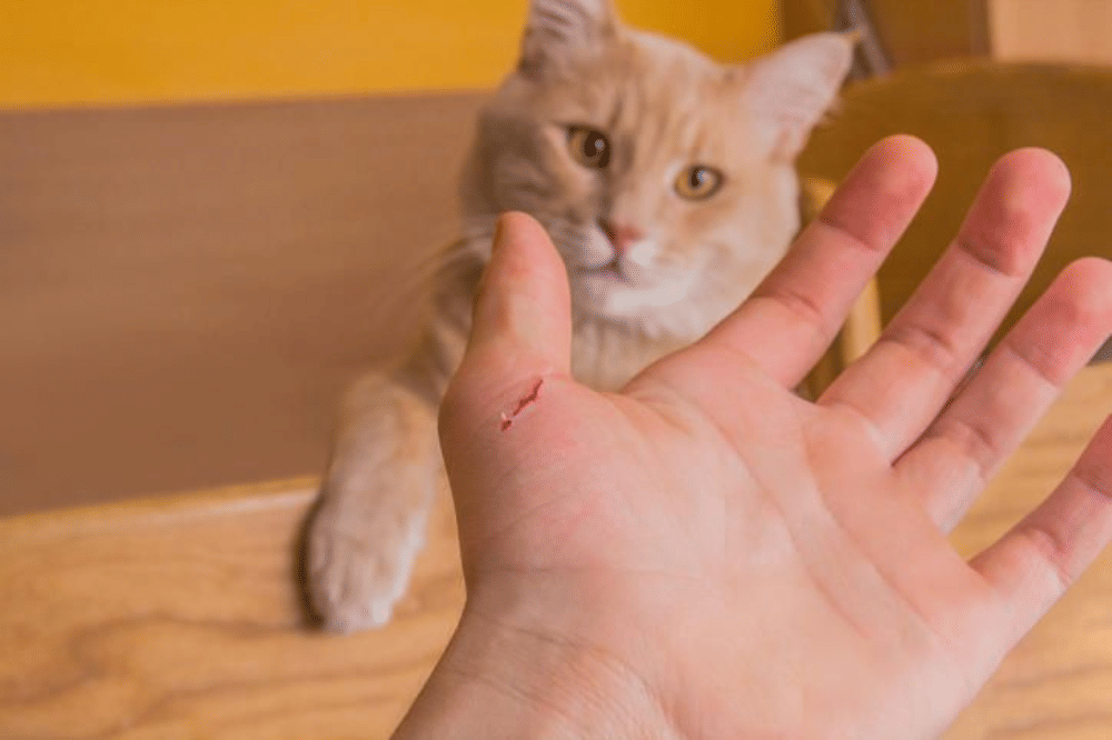 Cat Scratch Disease