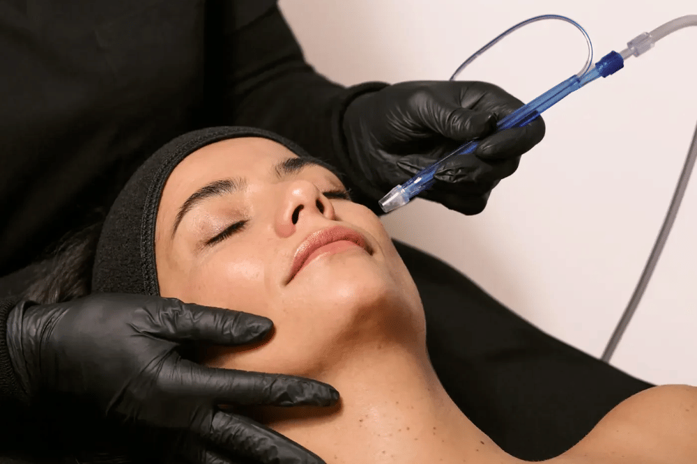 treatment pernikahan (3).png