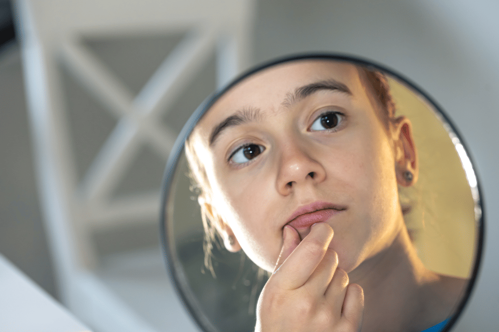 5 Cara Mencegah Bibir Kering dan Pecah-Pecah, Sudah Coba?