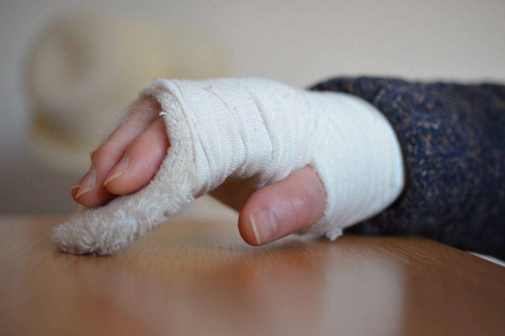 Pemakaian gips