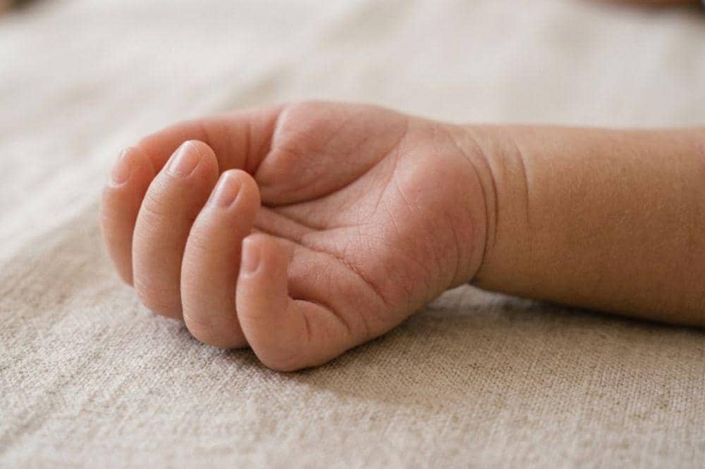 Syok anafilaktik akibat reaksi alergi berat