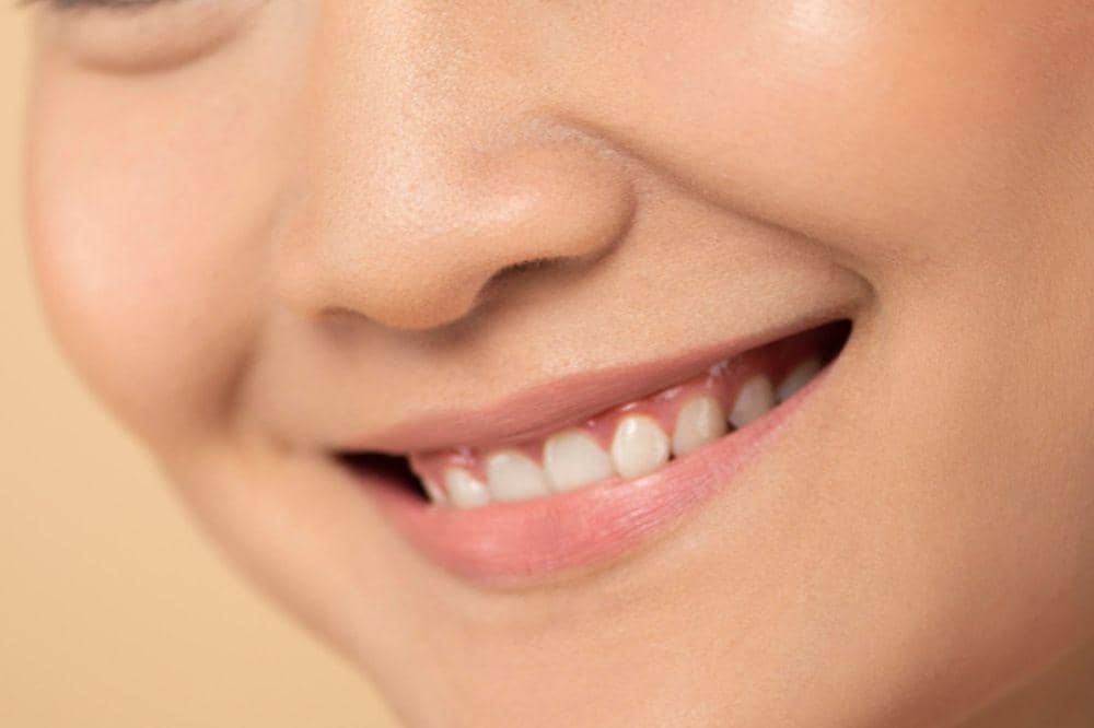 Smile line bisa semakin dalam seiring perubahan kulit