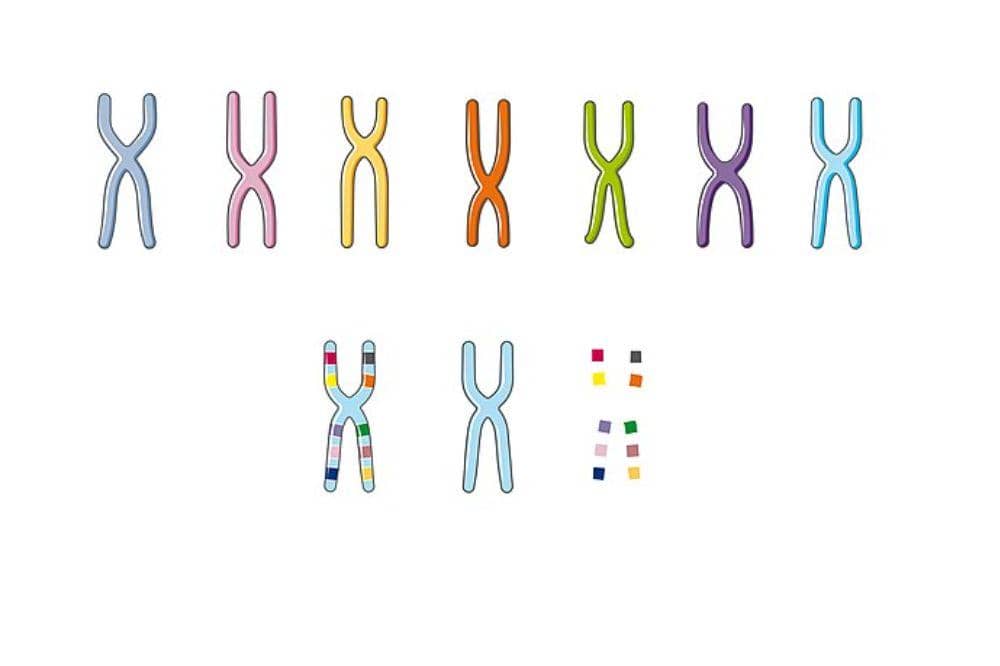 Sindrom insensitivitas androgen