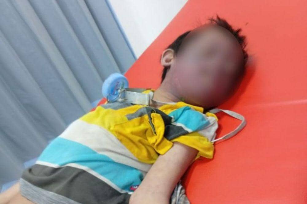Anak Berkebutuhan Khusus di Surabaya Tewas Usai Jadi Korban Bully