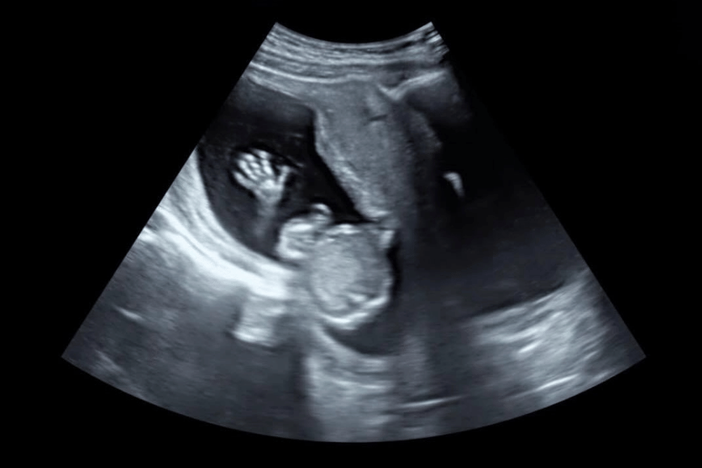 Foto Baby Maudy 