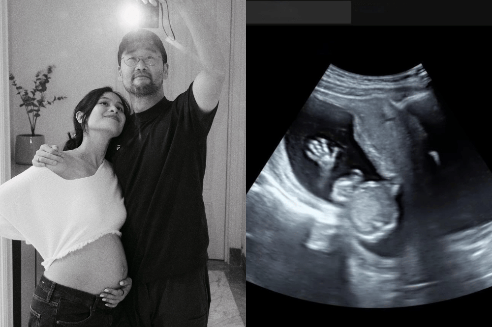 Hamil 7 Bulan, Maudy Ayunda Pamer Baby Bump dan Foto USG