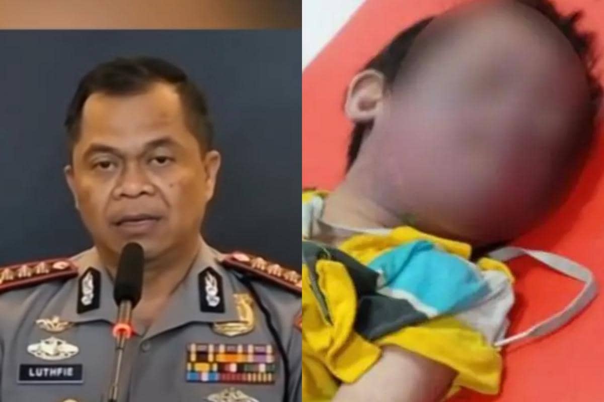 Update Kasus Bullying Anak sindrom Down di Surabaya: Ini Keputusan Hukum Terduga Pelaku