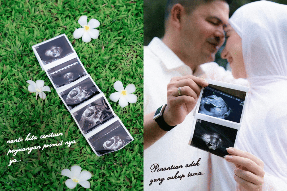 Perjalanan IVF Irish Bella, Sempat Ingin Menyerah tapi Bangkit Kembali