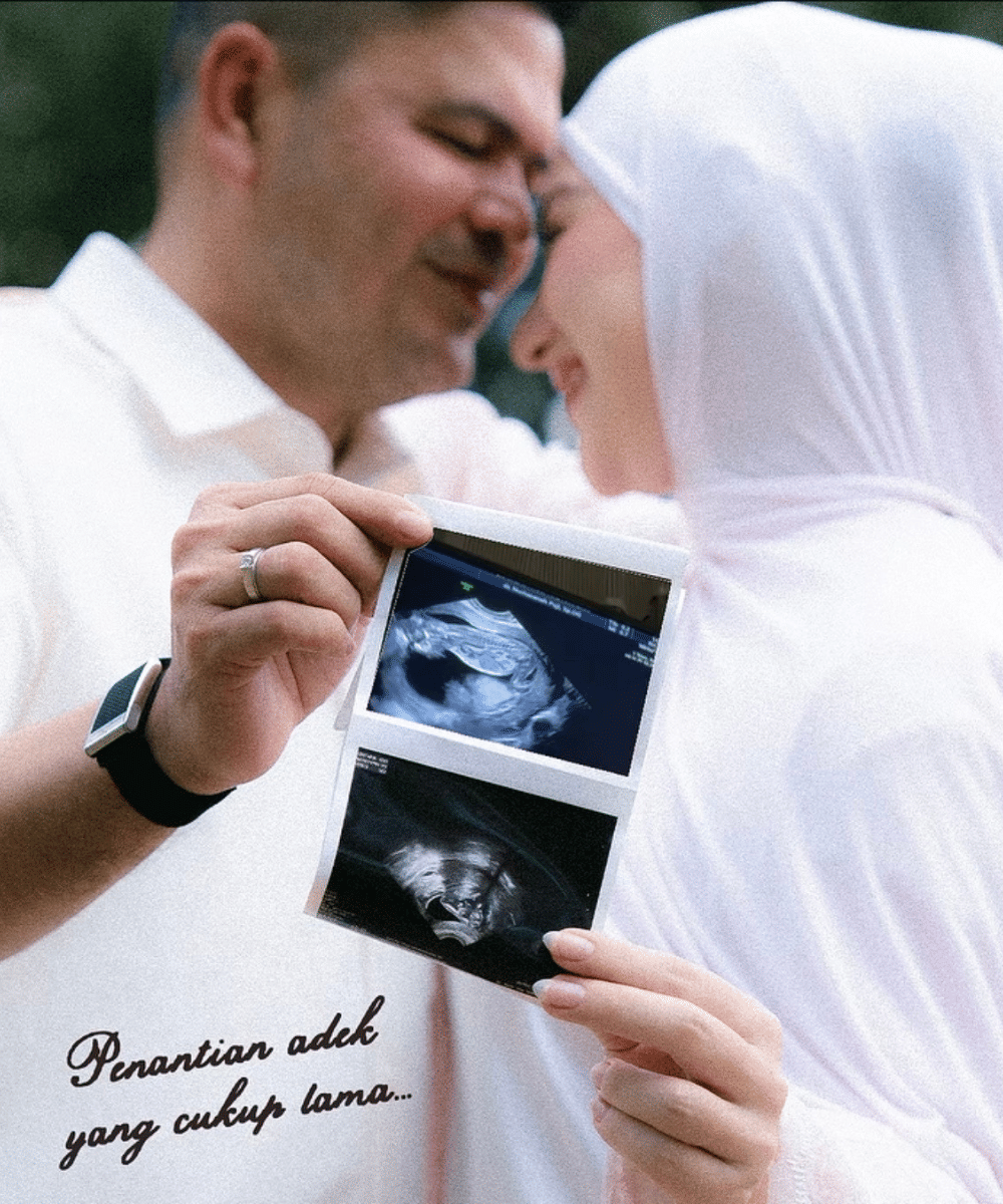 Perjalanan IVF Irish Bella (3)