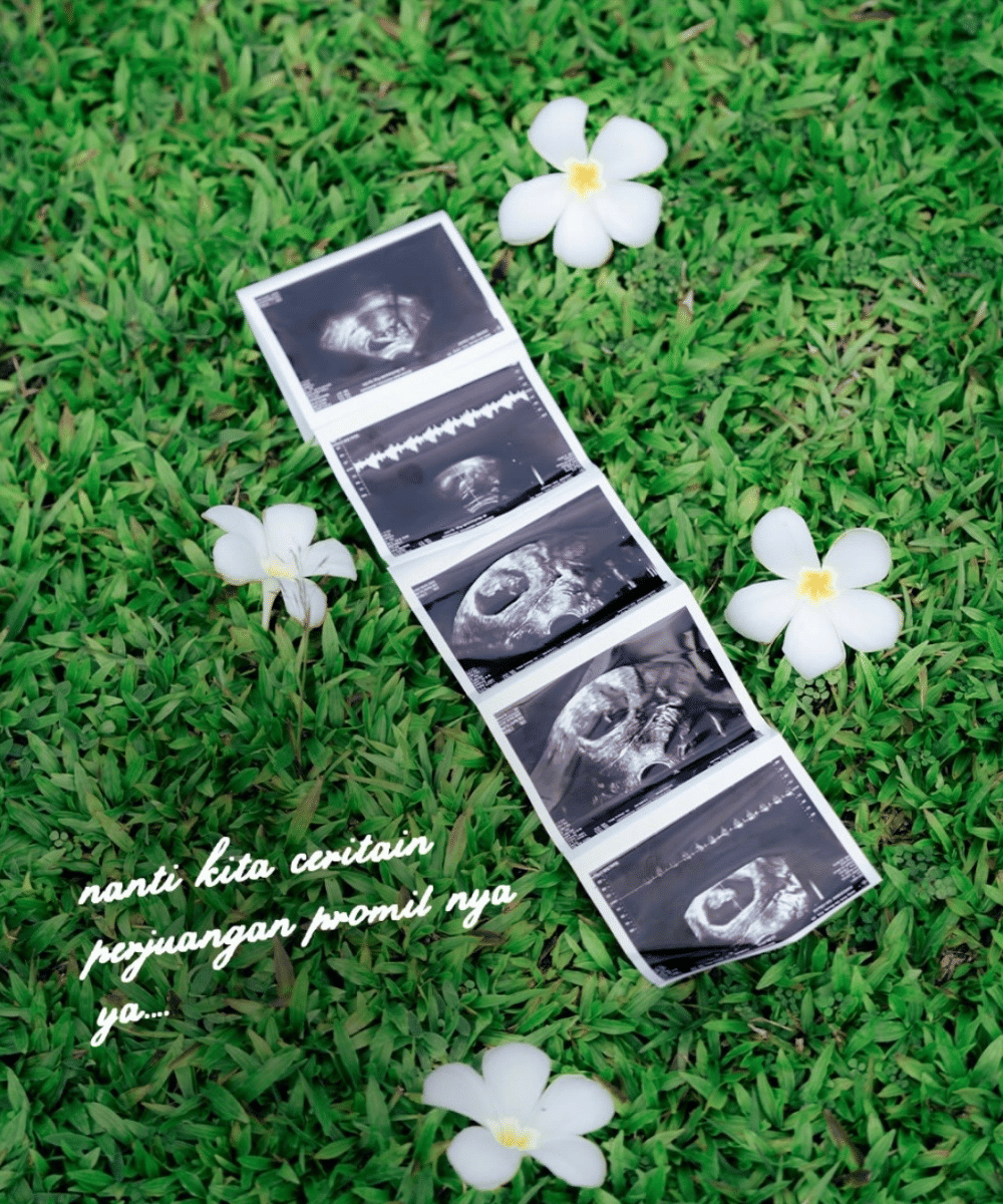 Perjalanan IVF Irish Bella (4)