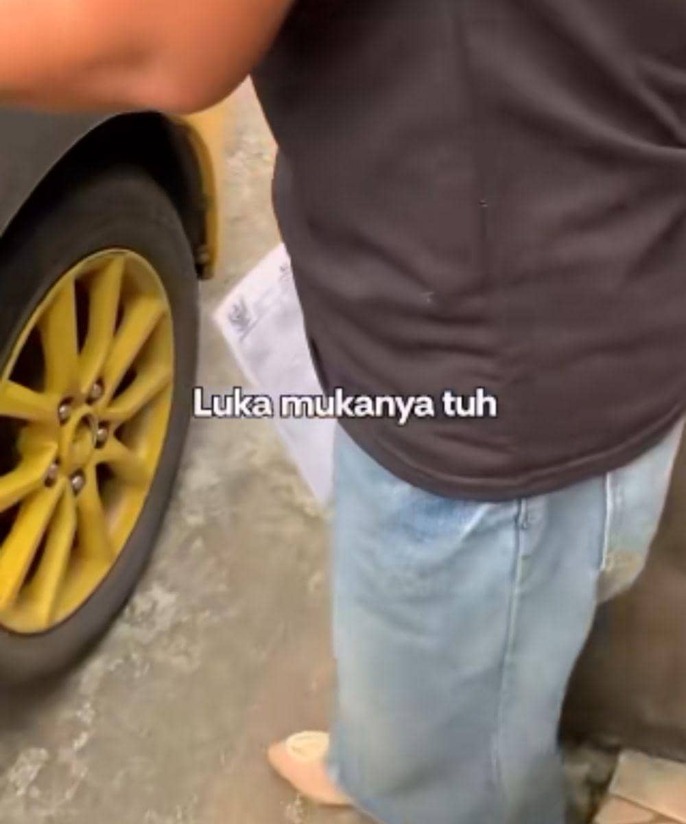 Sang Mama ditemukan syok dengan luka di bagian bibir